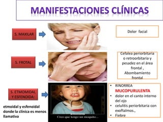 Dolor facial
S. FROTAL
S. MAXILAR
S. ETMOMIDAL
Y ESFENOIDA:
Cefalea periorbitaria
o retroorbitaria y
pesadez en el área
frontal ,
Abombamiento
frontal
• RINORREA
MUCOPURULENTA
• dolor en el canto interno
del ojo
• celulitis periorbitaria con
exoftalmos.,
• Fiebre
etmoidal y esfenoidal
donde la clínica es menos
llamativa
 