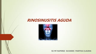 RINOSINUSITIS AGUDA
R2 MF RAMIREZ OLIVARES MARTHA CLAUDIA
 
