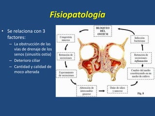 Fisiopatología
• Se relaciona con 3
factores:
– La obstrucción de las
vías de drenaje de los
senos (sinusitis ostia)
– Deterioro ciliar
– Cantidad y calidad de
moco alterada

 
