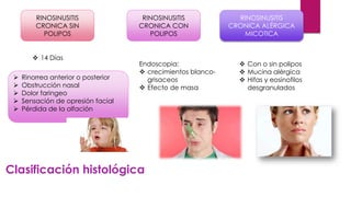 Clasificación histológica
 Rinorrea anterior o posterior
 Obstrucción nasal
 Dolor faringeo
 Sensación de opresión facial
 Pérdida de la olfación
RINOSINUSITIS
CRONICA SIN
POLIPOS
RINOSINUSITIS
CRONICA CON
POLIPOS
RINOSINUSITIS
CRONICA ALÉRGICA
MICOTICA
 14 Días
Endoscopia:
 crecimientos blanco-
grisaceos
 Efecto de masa
 Con o sin polipos
 Mucina alérgica
 Hifas y eosinofilos
desgranulados
 