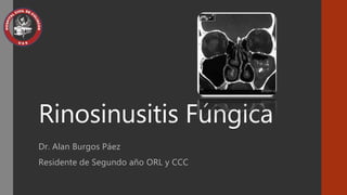 Rinosinusitis Fúngica 
Dr. Alan Burgos Páez 
Residente de Segundo año ORL y CCC 
 