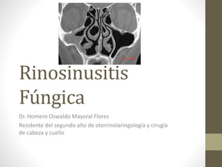 Rinosinusitis
Fúngica
Dr. Homero Oswaldo Mayoral Flores
Residente del segundo año de otorrinolaringología y cirugía
de cabeza y cuello
 