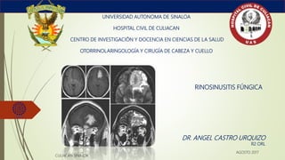 RINOSINUSITIS FÚNGICA
UNIVERSIDAD AUTONOMA DE SINALOA
HOSPITAL CIVIL DE CULIACAN
CENTRO DE INVESTIGACIÓN Y DOCENCIA EN CIENCIAS DE LA SALUD
OTORRINOLARINGOLOGÍA Y CIRUGÍA DE CABEZA Y CUELLO
DR. ANGEL CASTRO URQUIZO
R2 ORL
CULIACAN SINALOA
AGOSTO 2017
 