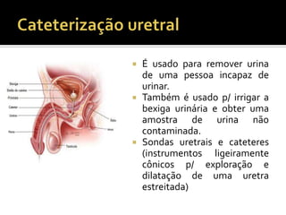  É usado para remover urina
de uma pessoa incapaz de
urinar.
 Também é usado p/ irrigar a
bexiga urinária e obter uma
amostra de urina não
contaminada.
 Sondas uretrais e cateteres
(instrumentos ligeiramente
cônicos p/ exploração e
dilatação de uma uretra
estreitada)
 