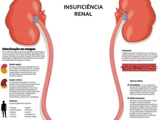 INSUFICIÊNCIA
RENAL
INSUFICIÊNCIA
RENAL
 