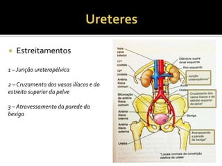  Estreitamentos
1 – Junção ureteropélvica
2 – Cruzamento dos vasos ilíacos e do
estreito superior da pelve
3 – Atravessamento da parede da
bexiga
 