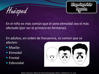 En el niño es más común que el seno etmoidal sea el más
afectado (por ser el primero en formarse).

En adultos, en orden de frecuencia, es común que se
afecten:
 Maxilar
 Etmoidal
 Frontal
 Esfenoidal

          Becker, Naumann. Manual de Otorrinolaringología. México; Antibioticos S. A. 2005.
 