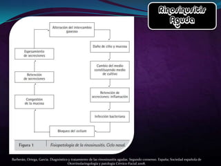 Barberán, Ortega, García. Diagnóstico y tratamiento de las rinosinusitis agudas. Segundo consenso. España; Sociedad española de
                                     Otorrinolaringología y patología Cérvico-Facial.2008.
 