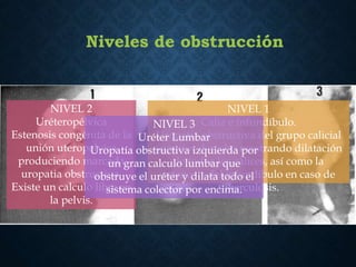 Niveles de obstrucción
NIVEL 1
Cáliz e infundíbulo.
Uropatia obstructiva del grupo calicial
superior derecho mostrando dilatación
de todos los cálices, así como la
estenosis del infundíbulo en caso de
tuberculosis.
NIVEL 2
Uréteropélvica
Estenosis congénita de la
unión uteropelvica
produciendo marcada
uropatia obstructiva.
Existe un calculo libre en
la pelvis.
NIVEL 3
Uréter Lumbar
Uropatía obstructiva izquierda por
un gran calculo lumbar que
obstruye el uréter y dilata todo el
sistema colector por encima.
 