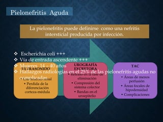 Pielonefritis Aguda
ULTRASONIDO
• Crecimiento renal
• Perdida de la
diferenciación
corteza-médula
UROGRAFÍA
EXCRETORA
• Retraso en la fase de
eliminación
• Compresión del
sistema colector
• Bandas en el
uroepitelio
TAC
• Áreas de menos
perfusión
• Áreas focales de
hipodensidad
• Complicaciones
 Escherichia coli +++
 Vía de entrada ascendente +++
 Mujeres 14 – 40 años
 Hallazgos radiologías en el 25% de las pielonefritis agudas no
complicadas.
La pielonefritis puede definirse como una nefritis
intersticial producida por infección.
 