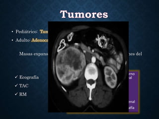 • Pediátrico: Tumor de Wilms
• Adulto: Adenocarcinoma de células claras
Masas expansivas e invasivas que causan deformaciones del
sistema pielocalicial.
 Ecografía
 TAC
 RM
1. Masa con deformidad del contorno
renal y destrucción pielocaliceal
2. Hemorragia y necrosis
3. Realzamiento heterogéneo
4. Calcificación (10%)
5. Invasión del seno renal y vena renal
6. 95% hipervasculares en angiografía
 