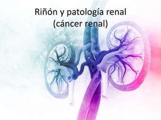 Riñón y patología renal
(cáncer renal)
 