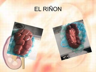 Riñon Extraido Laboratorio sobre el Riñon | PPTX