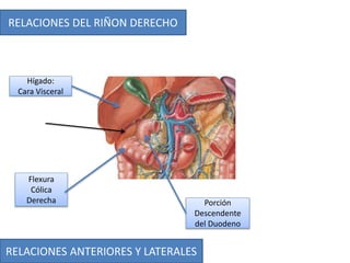 RELACIONES ANTERIORES Y LATERALES
RELACIONES DEL RIÑON DERECHO
Hígado:
Cara Visceral
Flexura
Cólica
Derecha Porción
Descendente
del Duodeno