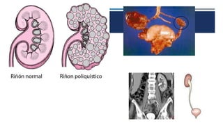 RIÑON (1).pptx