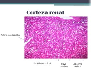 Corteza renal



Arteria interlobulillar




                            Laberinto cortical    Rayo     Laberinto
                                                 medular    cortical
 