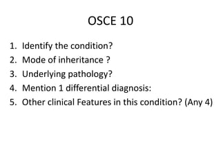 OSCE 10
1. Identify the condition?
2. Mode of inheritance ?
3. Underlying pathology?
4. Mention 1 differential diagnosis:
5. Other clinical Features in this condition? (Any 4)
 
