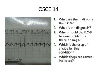 OSCE 14
1. What are the findings in
the E.C.G?
2. What is the diagnosis?
3. When should the E.C.G
be done to identify
these findings?
4. Which is the drug of
choice for this
condition?
5. Which drugs are contra-
indicated?
 