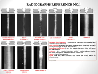 RADIOGRAPHS REFERENCE NO.1
EXCESSIVE ROOT
PENETRATION
ROOT
CONCAVITY
INCOMPLETE
FILLED GROOVE
CAP UNDERCUT ROOT
UNDERCUT
SPATTER
LONGITUDINAL
CRACK
TRANSVERSE
CRACK
CRATER CRACK
Excessive Root Penetration: a continuous or intermittent light irregular band
within the image of the weld.
Root Concavity: a series of dark areas along the centre of the weld varying in
density according to the depth of imperfection.
Incomplete Filled Groove: a dark area towards the centre of the weld which
has diffuse edges.
Undercut: a dark / irregular/ intermittent band in a position adjacent to either
the cap or root weld toe or between adjacent capping runs.
Spatter: small light/white spots.
Crack: dark, fine often branching lines which are usually diffuse or
discontinuous.
Copyright2013:KAOriginal
Prepared by Kamarul Ariffin, (PCFSSB)
 