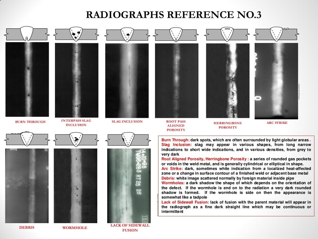 Radiographic interpretation