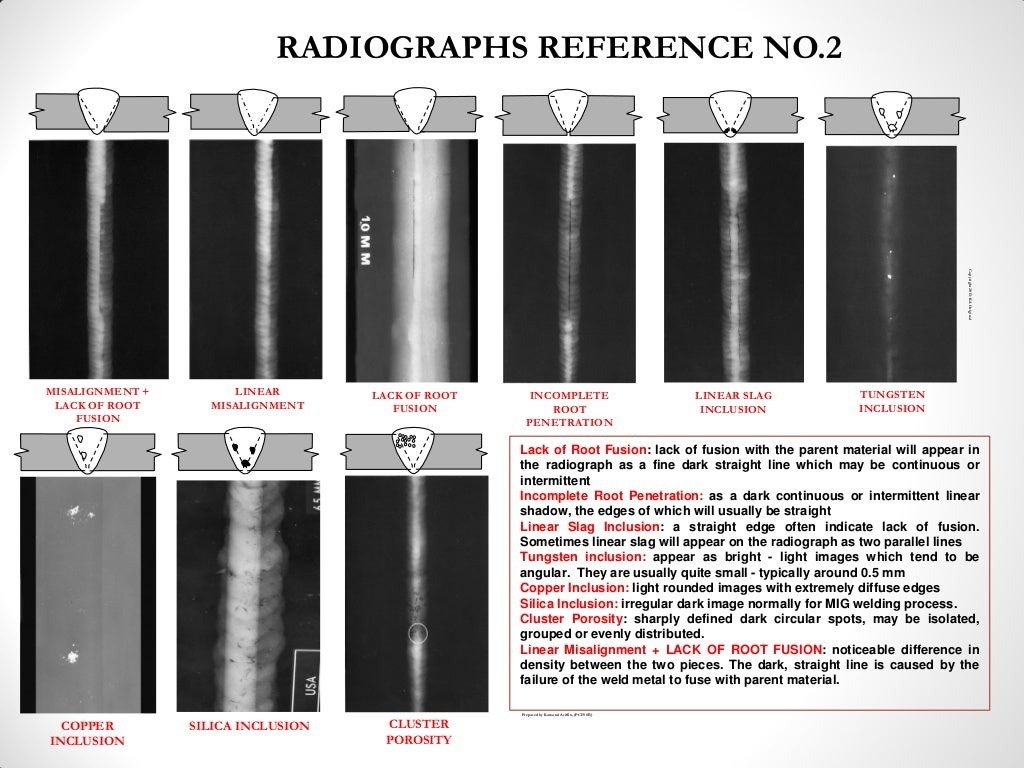 Radiographic interpretation