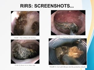 RIRS: SCREENSHOTS...
 