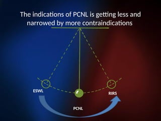 The indications of PCNL is getting less and
narrowed by more contraindications
PCNL
ESWL
RIRS
 