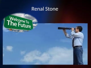 Renal Stone
PCNL is here
to stay
PCNL will go
away
 