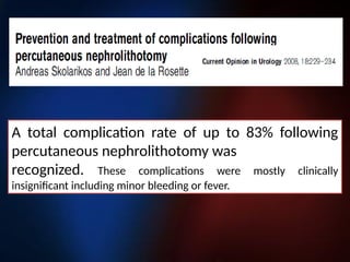 A total complication rate of up to 83% following
percutaneous nephrolithotomy was
recognized. These complications were mostly clinically
insignificant including minor bleeding or fever.
 