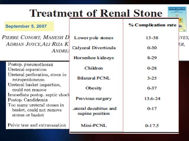 RIRS VS PNL (2) point counter point ppt | PPT