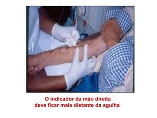 O indicador da mão direita  deve ficar mais distante da agulha    