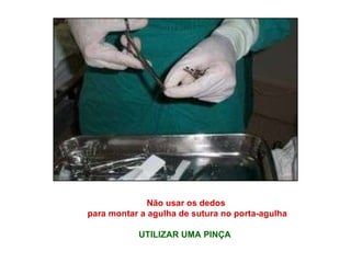 Não usar os dedos para montar a agulha de sutura no porta-agulha UTILIZAR UMA PINÇA    