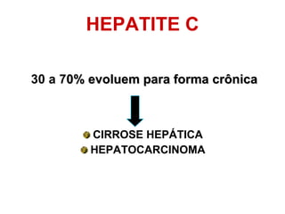 30 a 7 0% evoluem para forma crônica CIRROSE HEPÁTICA HEPATOCARCINOMA HEPATITE C 
