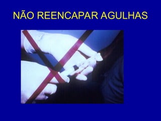 NÃO REENCAPAR AGULHAS
 