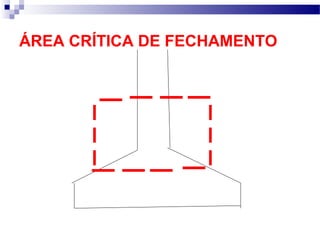ÁREA CRÍTICA DE FECHAMENTO
 