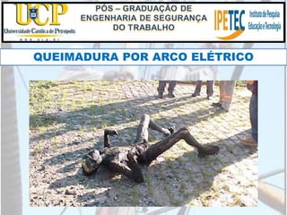 QUEIMADURA POR ARCO ELÉTRICO
 