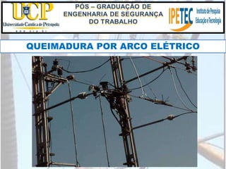 QUEIMADURA POR ARCO ELÉTRICO
 