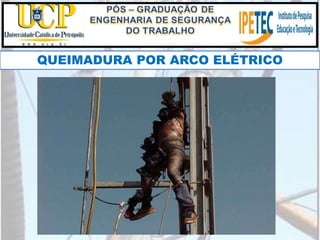 QUEIMADURA POR ARCO ELÉTRICO
 