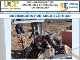 QUEIMADURA POR ARCO ELÉTRICO
 