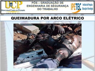 QUEIMADURA POR ARCO ELÉTRICO
 