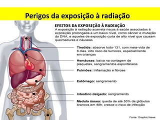 Perigos da exposição à radiação

 