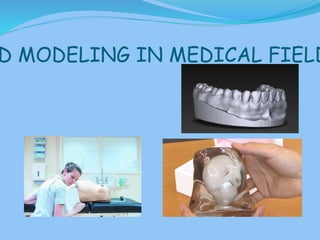 D MODELING IN MEDICAL FIELD
 