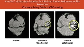 Risk assessment for cardiovascular disease prevention | PDF