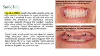 risk factors for implant pre and post.pptx