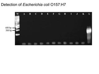 Determination of risk factors contributing to microbial contamination in milk and identification of presence of selected pathogenic bacteria along dairy value chain in Tanga