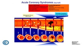 Risk stratfication of ACS | PPTX