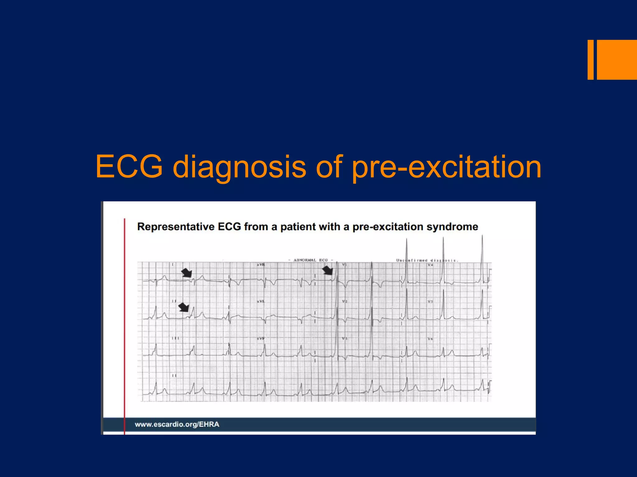 Risk stratification to prevent SCD in young athletes | PPT
