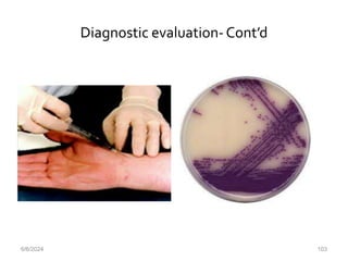 Diagnostic evaluation-Cont’d
6/6/2024 103
 