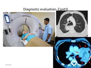 Diagnostic evaluation- Cont’d
6/6/2024 108
 