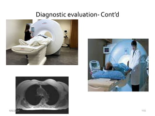 Diagnostic evaluation-Cont’d
6/6/2024 110
 